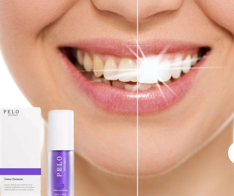 Purple Teeth Whitening Gel, Purple Teeth Whitening, Colour Correcting, Tooth Stain Removal, Teeth Whitening Kit, Color Corrector for Yellow Tones