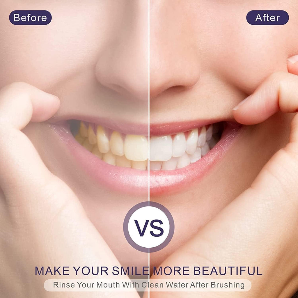 Purple Teeth Whitening Gel, Purple Teeth Whitening, Colour Correcting, Tooth Stain Removal, Teeth Whitening Kit, Color Corrector for Yellow Tones