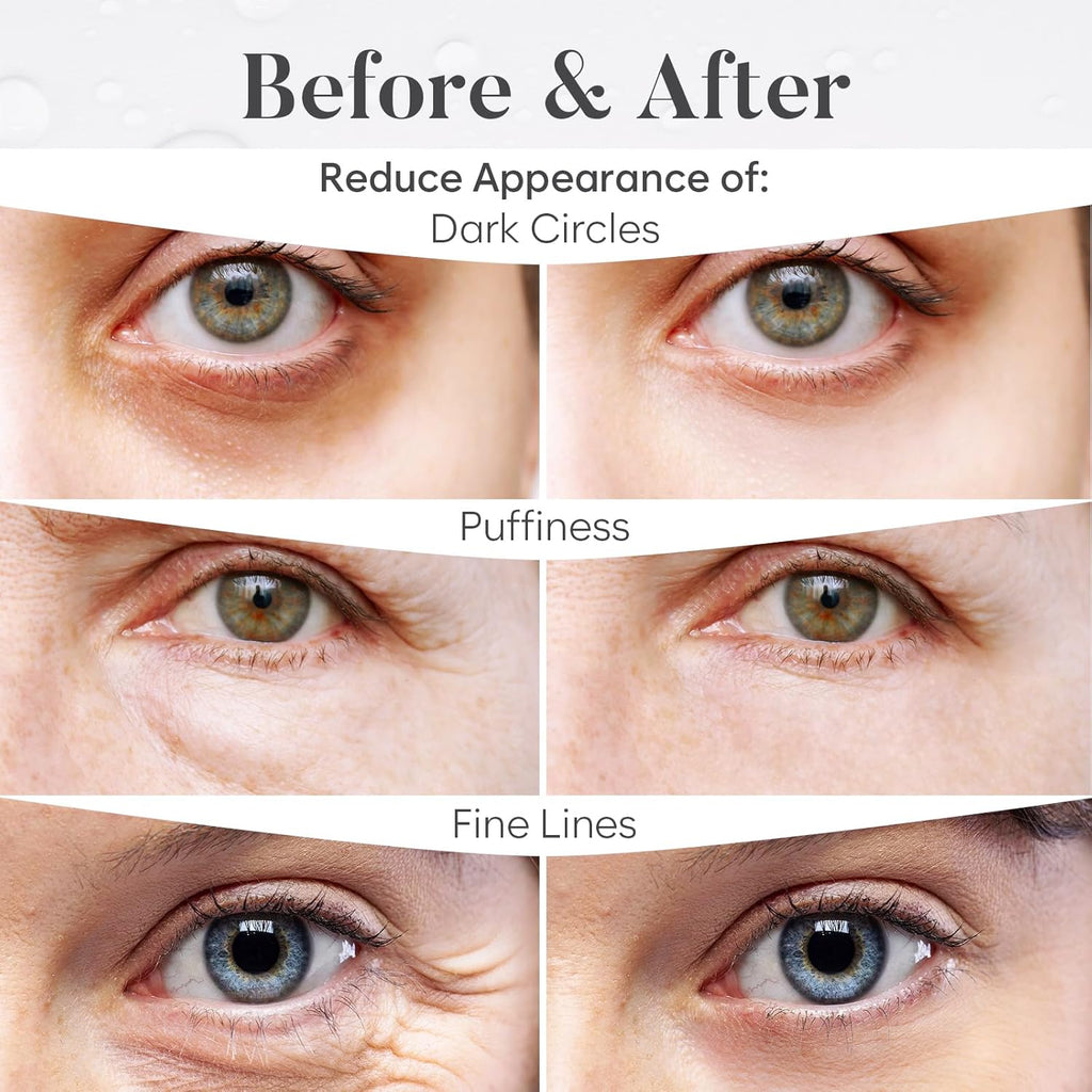 Variety under Eye Patches (30 Pairs) - Eye Mask for Dark Circles, Puffy Eyes & Wrinkles - 6 Varieties with Hyaluronic Acid, Green Tea, Rose, 24K Gold, Retinol, Collagen & Caffeine